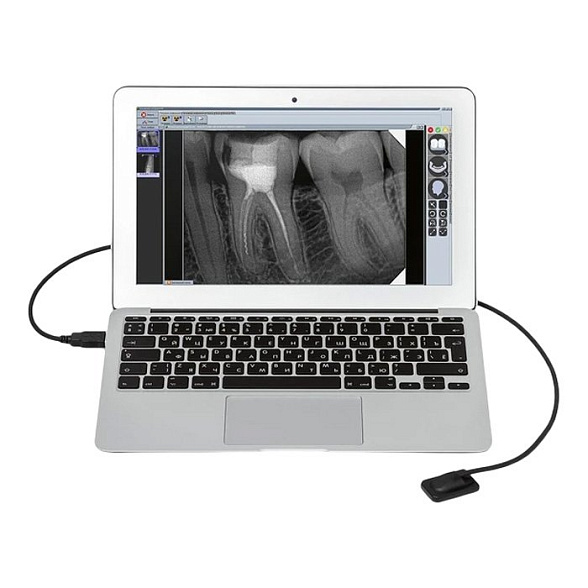 Комплект рентген Evolution X3000 и визиограф Mercury DIGISENS