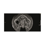 Gendex Pan eXam Plus 2D - дентальный цифровой томограф