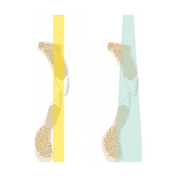 KaVo Pan eXam Plus 3D Ceph (2 датчика) - универсальный датчик Pan/Ceph для панорамной томографии, цефалостат, функция 3D-томографии 6x8 см