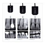 Vatech EzSensor - цифровой радиовизиограф