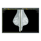 Аппаратно-программный комплекс «ДИАРМ-МТ-Плюс»