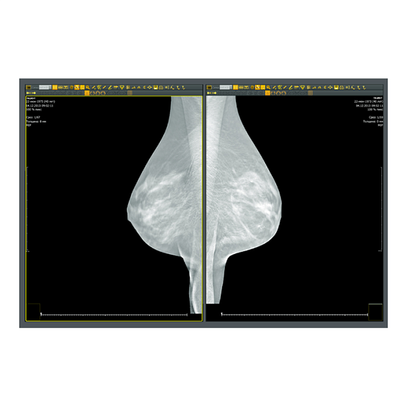 Аппаратно-программный комплекс «ДИАРМ-МТ-Плюс»