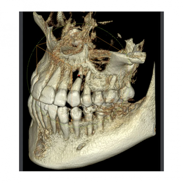 RAYSCAN Symphony Alpha PANO - ортопантомограф с возможностью дооснащения цефалостатом и компьютерным томографом