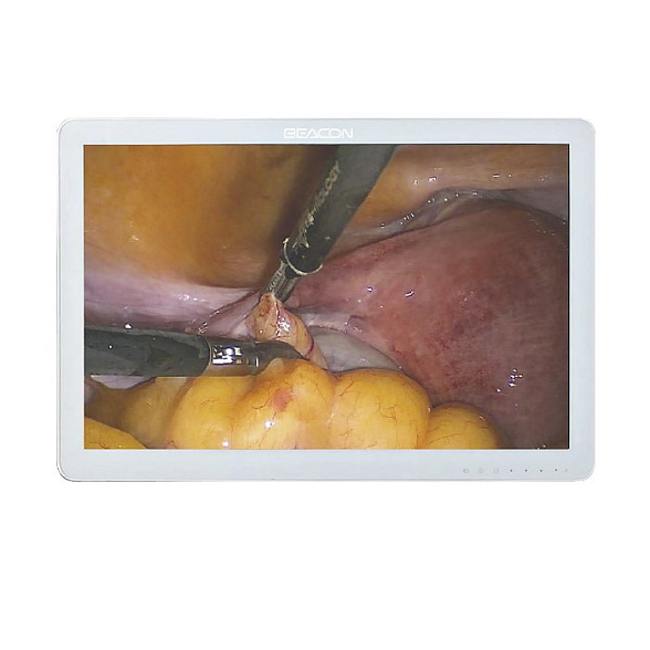 Монитор для эндоскопа 24 дюйма Huger
