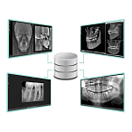 FONA Stellaris - система компьютерной стоматологической радиографии