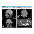 Информационная система АПК АрхиМед PACS/RIS