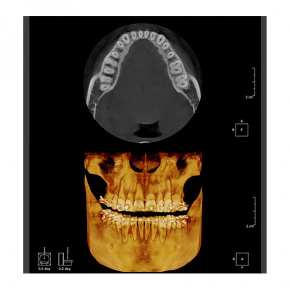 RAYSCAN Symphony Alpha PANO - ортопантомограф с возможностью дооснащения цефалостатом и компьютерным томографом