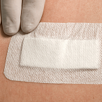 Повязка пластырного типа, впитывающая, стерильная, "Докапласт", 6*10см., №25