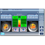 Авторефрактометр VX120+ DRY EYE