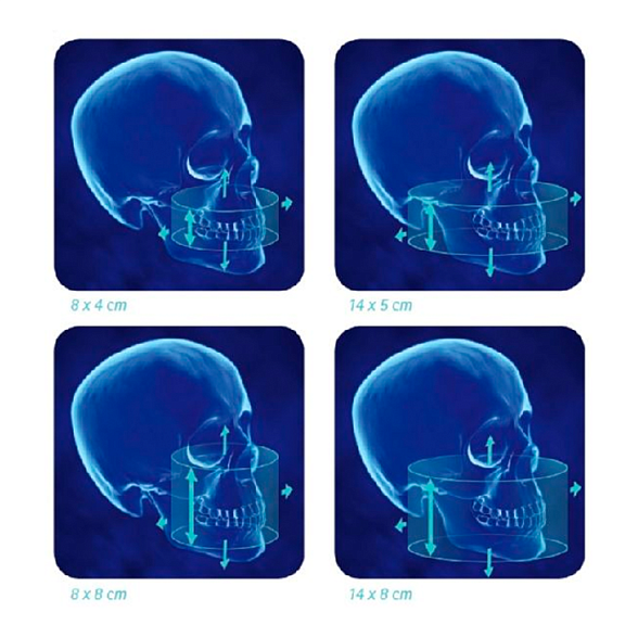 i-CAT 3D eXam / i-CAT - аппарат панорамный рентгеновский стоматологический с функцией томографии