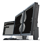 AI-платформа для анализа маммограмм ТриоДМ-МТ