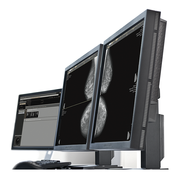 AI-платформа для анализа маммограмм ТриоДМ-МТ