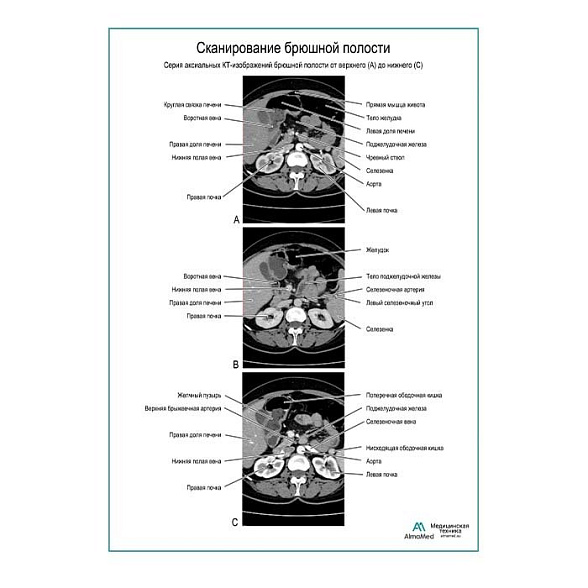 Сканирование брюшной полости плакат глянцевый  А1+/А2+ (глянцевая фотобумага от 200 г/кв.м, размер A2+)