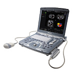 Портативный ультразвуковой аппарат GE Healthcare Voluson E