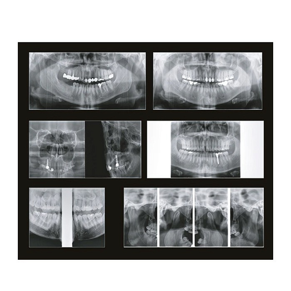 Papaya 3D Plus 16x8 - компьютерный томограф с цефалостатом