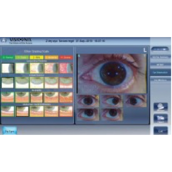 Авторефрактометр VX120+ DRY EYE