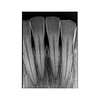 Carestream Dental RVG 5200 - радиовизиограф, 16 пар линий/мм