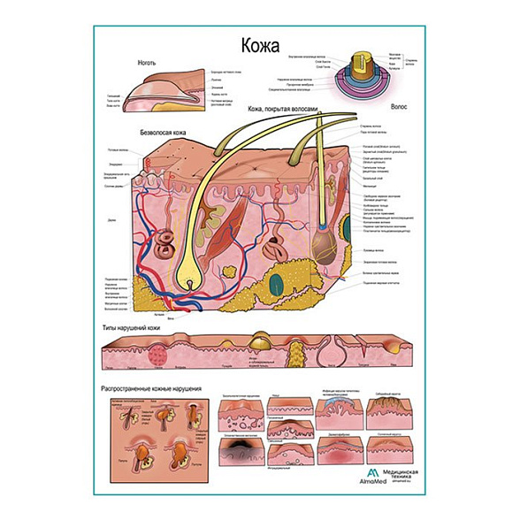 Кожа и типы нарушений, плакат глянцевый  А1+/А2+ (глянцевая фотобумага от 200 г/кв.м, размер A2+)