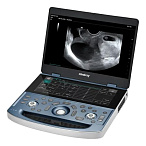 Ультразвуковой аппарат Mindray MX7