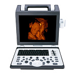 Портативный УЗИ аппарат SIUI CTS-7700