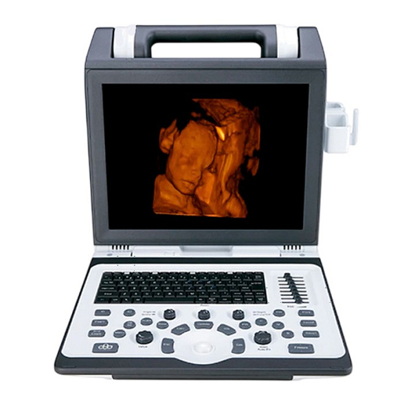 Портативный УЗИ аппарат SIUI CTS-7700