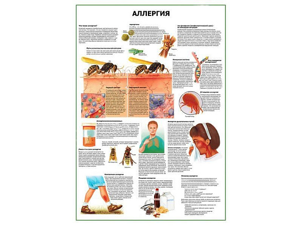 OLD Аллергия плакат глянцевый А1/А2 (глянцевый A1)