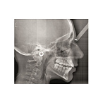 Gendex Pan eXam Plus 2D - дентальный цифровой томограф