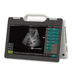УЗИ сканер SmartScan 15