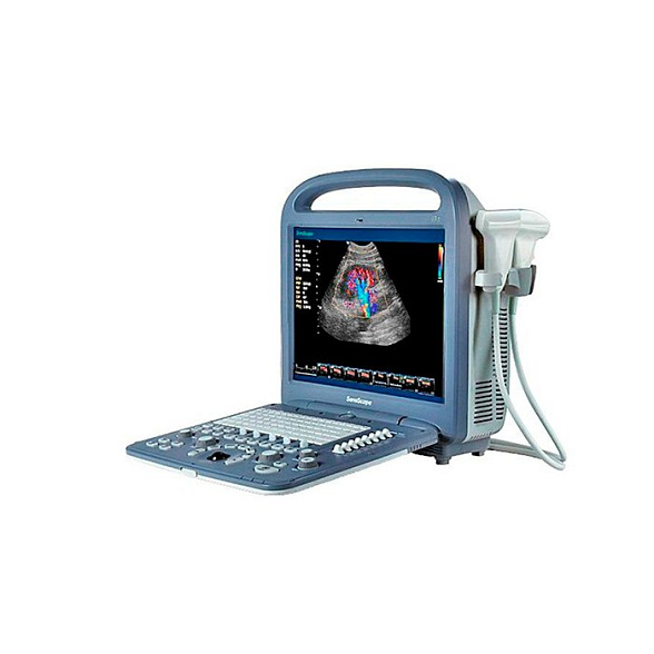 Ультразвуковой сканер S2 SonoScape