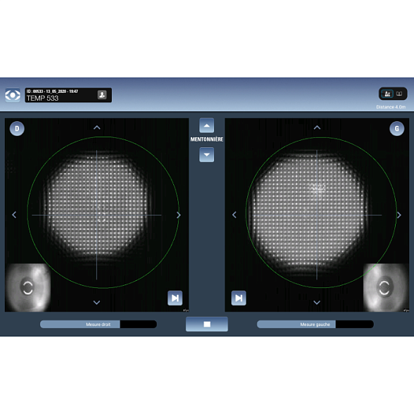Автоматическая система для аберрометрии EyeRefract