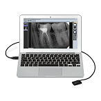 New Life Radiology Mercury DIGISENS - цифровой радиовизиограф