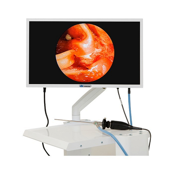 Видеокамера эндоскопическая с принадлежностями, вариант исполнения: F-368D (DS.Vision FHD 3in1), DS Med