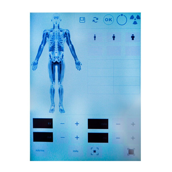 Портативный рентген DS.Xray 5610tb