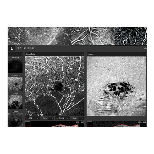 Томограф спектральный оптический когерентный, вариант исполнения: НОСТ-1, HUVITZ