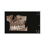 Gendex Pan eXam Plus 2D - дентальный цифровой томограф