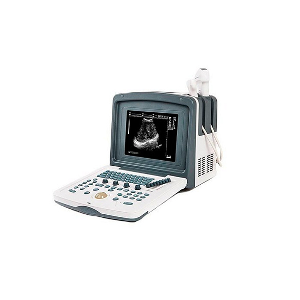 Цифровой УЗИ сканер АсuVista RS880f