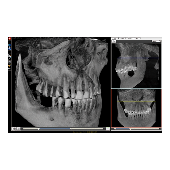 Fona XPan 3D - рентгенографическая цифровая система панорамной съемки