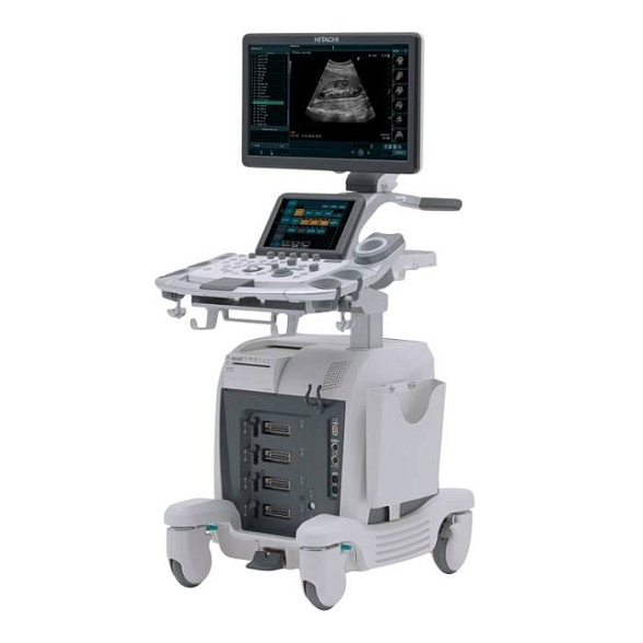 УЗИ аппарат Hitachi Arietta 65
