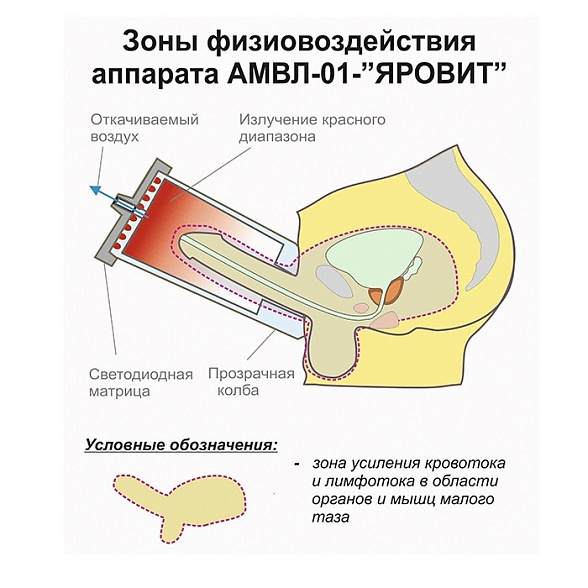 Аппарат – массажёр вакуумный фототерапевтический АМВЛ-01 Яровит с автономным управлением Яровит - Ярь
