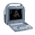 Портативный УЗИ аппарат CTS-5500 Plus SIUI