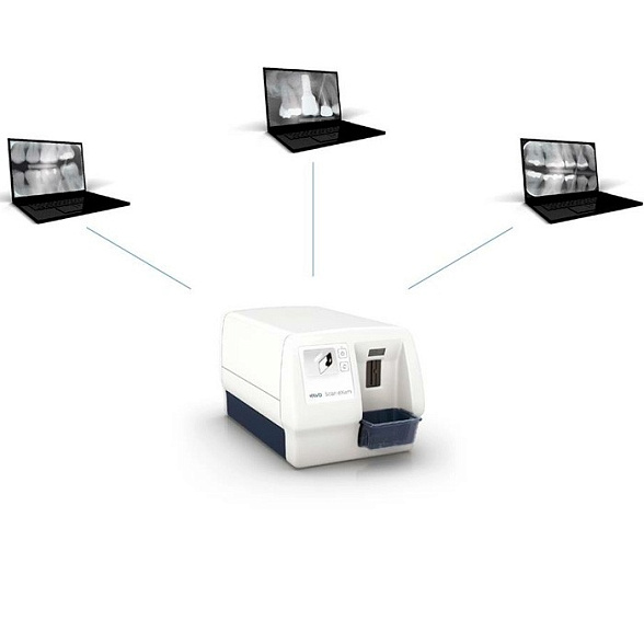 KaVo Scan eXam test drive Сканер фосфорных пластин. Высокая детализация изображения.