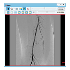 Информационная система АПК АрхиМед PACS/RIS