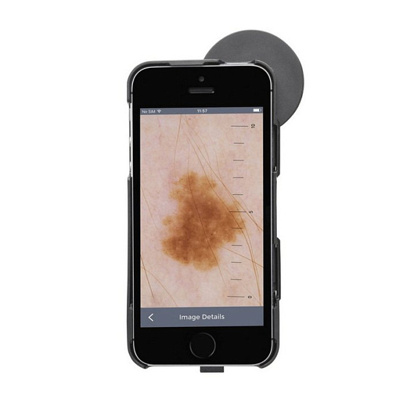 Дерматоскоп iC1 в наборе SET/7