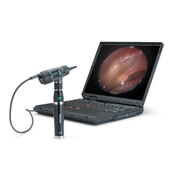 Отоскоп MacroView со встроенным диагностическим фонариком, номер по каталогу 23820