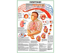 OLD Гипертония плакат глянцевый А1/А2 (глянцевый A2)