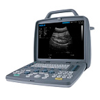 Портативный УЗИ аппарат SIUI CTS-6600