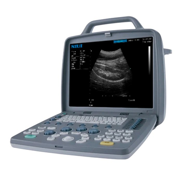 Портативный УЗИ аппарат SIUI CTS-6600