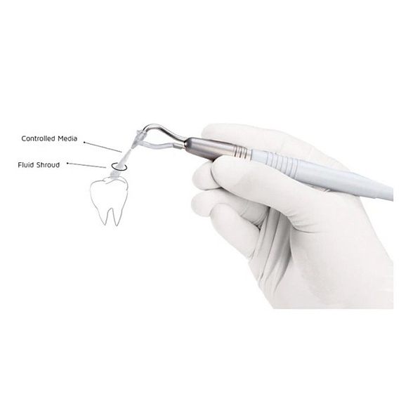 Пластиковые насадки для наконечника AquaCare (50 шт), Velopex