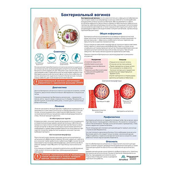 Бактериальный вагиноз медицинский плакат А1+/A2+ (глянцевая фотобумага от 200 г/кв.м, размер A2+)